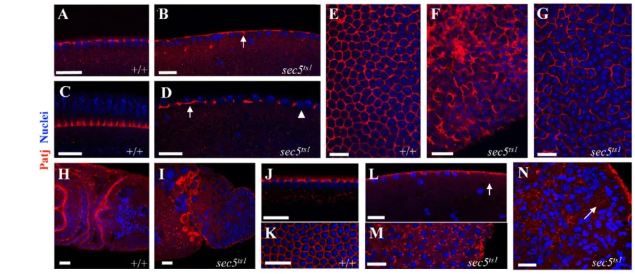 Fig. 4. sec5Although their nuclear densities were comparable, in mutants either the hexagonal array was completely disorganized (F, a surface view of B), or abroken array formed around multiple nuclei (G, a surface view of D)