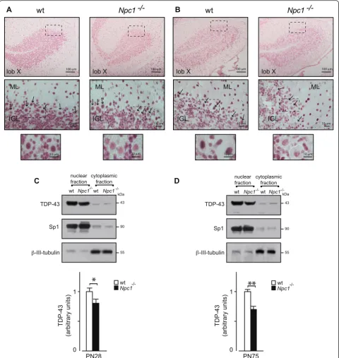 Fig. 2 TDP-43 immunohistochemistry of cerebellum sections of wt and Npc1−/− PN28 (a) and PN75 (b) mice