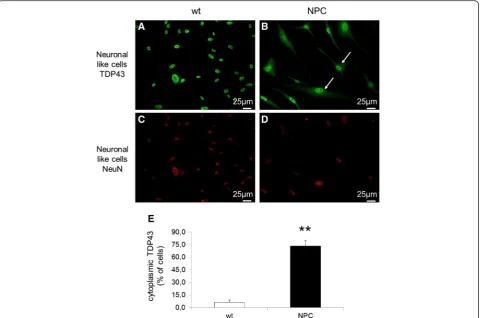 Fig. 3 Intracellular localization of TDP-43 (labeled in green) in neuron-like cells obtained from wt (a) and NPC patients (b)