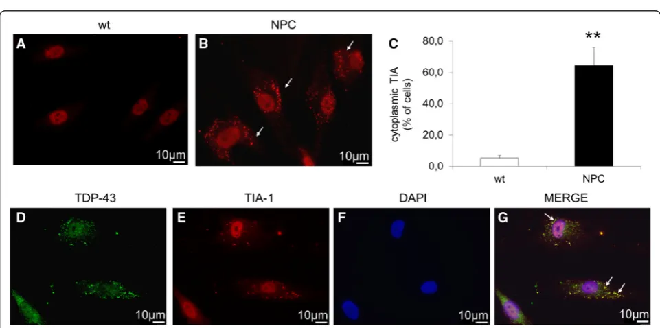Fig. 4 Immunofluorescence of phospho-TDP-43 (labeled inmarker p62 (labeled in red) in wt (a) and NPC (b) neuron-like cells