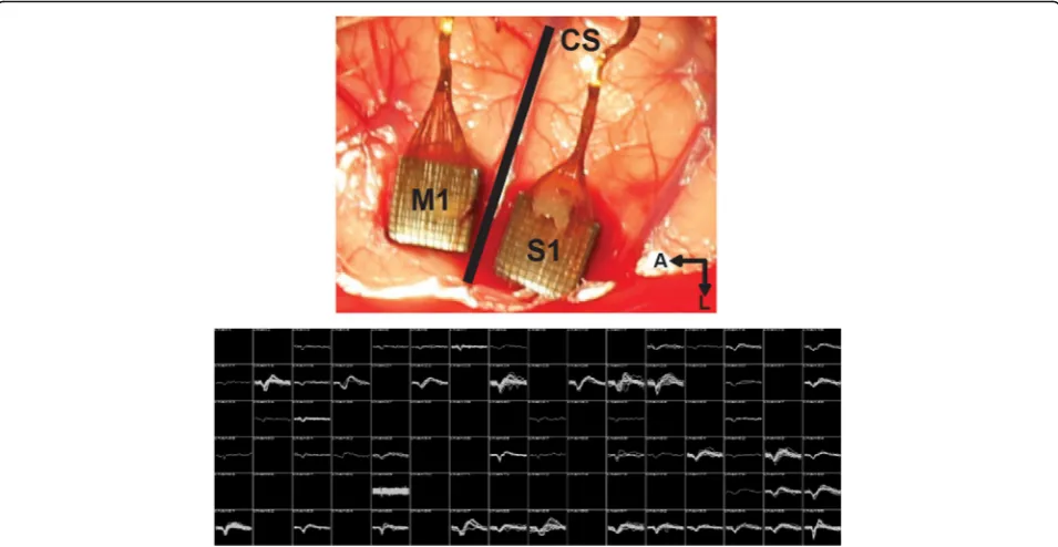 Fig. 5 (Top) Surgical photo of Utah arrays implanted in the motor and sensory cortex of a rhesus macaque