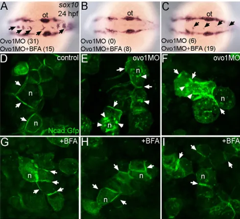 Fig. 6. Inhibition of intracellular trafficking rescues the Ovo1morphant phenotype.example with >5 cells per aggregate over both the midbrain andhindbrain