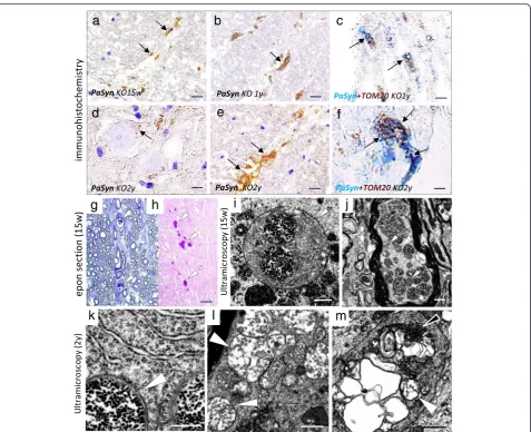 Fig. 3 Age-dependent morphological changes in PAnterior column of the spinal cord;immunohistochemistry for PαSyn-positive mitochondria in axons