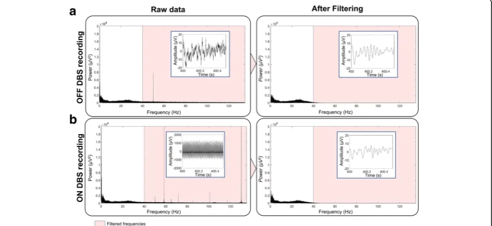 Table 1 Summary of EEG DBS studies and their principal results. Subjects number were given only for those who had directstimulation or ON/OFF DBS protocol (Continued)
