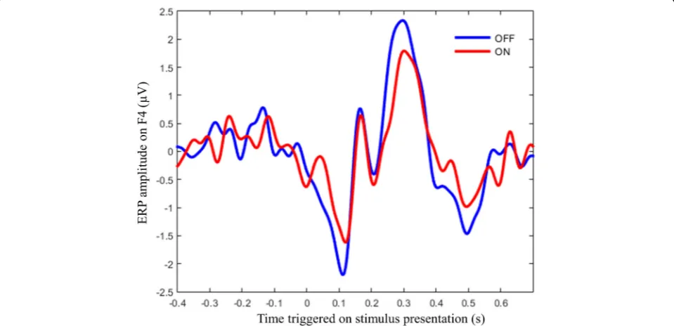 Fig. 3 Modulation of a cognitive ERP by DBS. This plot shows a grand average over 12 OCD patients stimulated in the STN at 130 Hz of the ERPin right fronto-central electrodes during a stop signal task