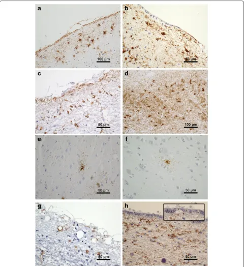 Fig. 1 Examples of tau pathologies in the cohort.processes in striatum and, a. Subpial TSA temporal cortex