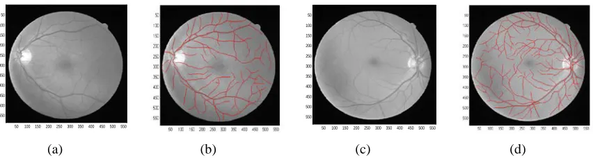 Figure 2 Performances Comparison Between (A) Direct Exploratory Approach And (B) Proposed Method With Vessel Bifurcation