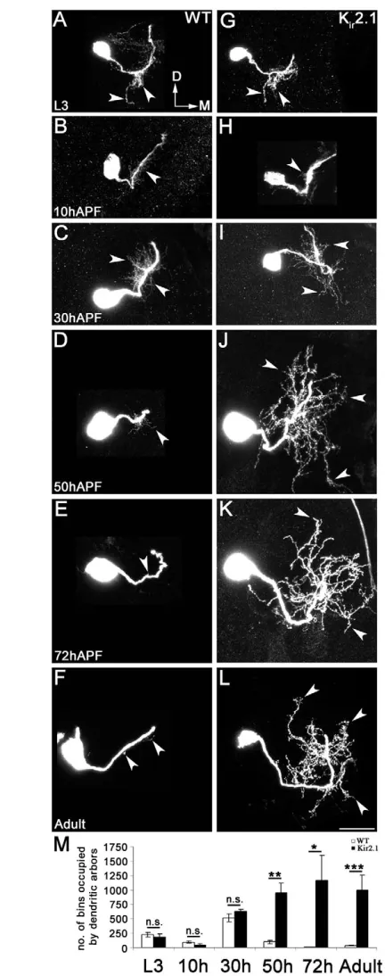 Fig. 1. Metamorphosis of the dendrites of the CSDn during pupallife. Pexuberant. Images are oriented as indicated in A