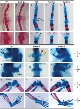 Fig. 5. Skeletal preparation of the limb of wild-type andmutant mice. Skeletal preparations at 4 weeks of age