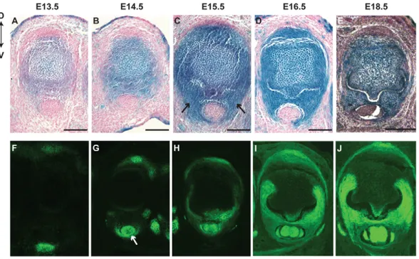 Fig. 6. Trichrome staining on P0 forelimb sections at the MP joint. (wild-type forelimb (B), the reduced ventral FDS tendon (E, arrow) and reduced tip of metacarpal and sesamoids (E, arrowhead and s), whereas only in sesamoids (F, s) and the tip of metacar