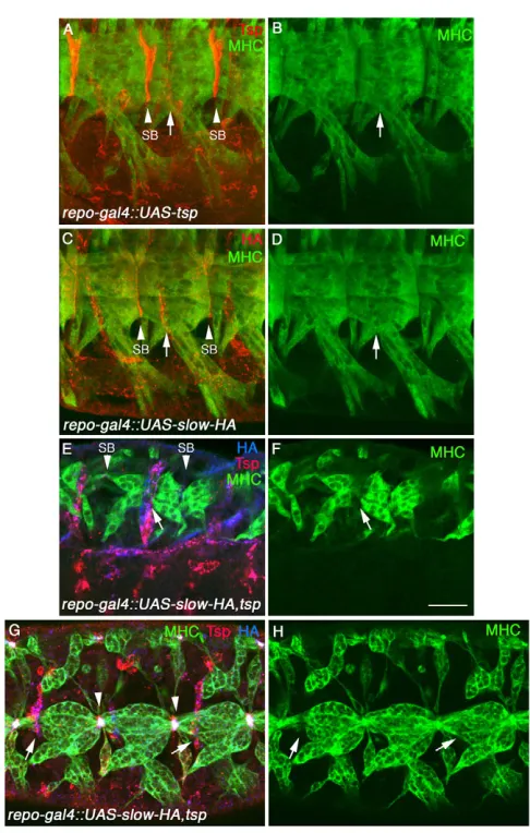 Fig. 9. Ectopic overexpression of both Slow and Tsp promotesaberrant muscle pattern and morphological changes at themuscle leading edges