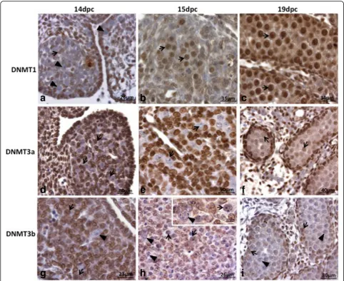 Fig. 1 DNMT1, DNMT3a and DNMT3b labelling in male rat embryonic gonads. DNMT1 was not detected in PGC (gonocytes and was detected in Sertoli cells (DNMT3b-positive (labelling, indicating that PGC reprogramming ends around 15dpc