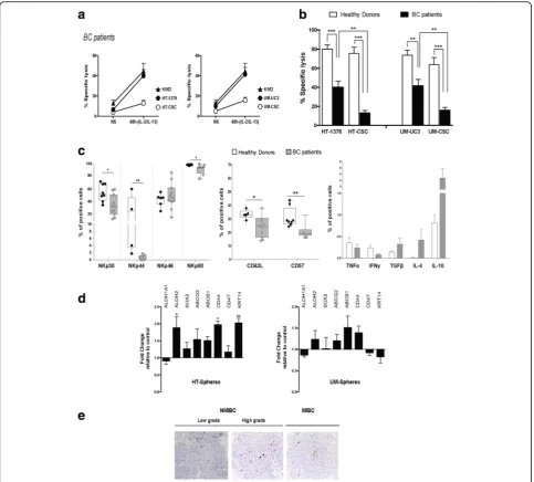 Fig. 4 NK cells from bladder cancer (BC) patients have impaired cytolytic activity and are ineffective against cancer stem-like cells