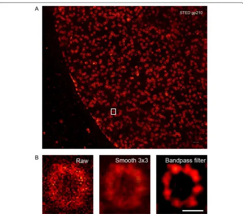 Fig. 3 Enhancing image contrast by band pass filter improves visualization of gp210 clusters in noisy STED images.STED image of gp210.filter (right)