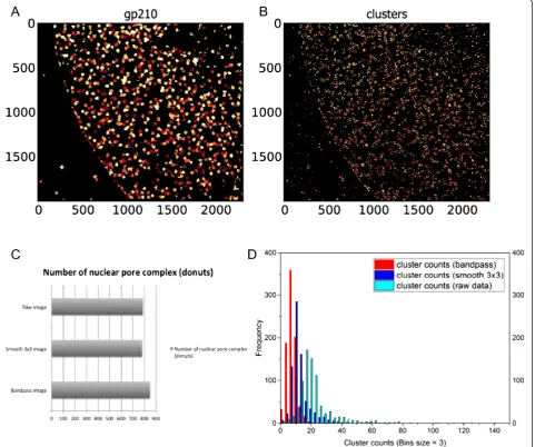 Fig. 4 Comparing segmentation results on raw STED image, with and without 3x3 smooth or band pass filters