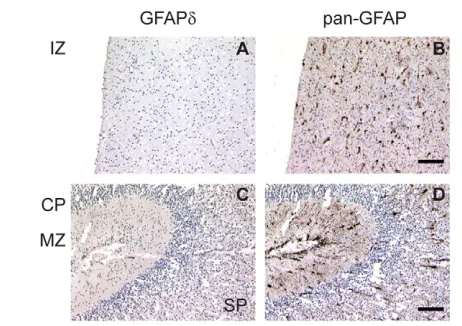 Fig. 3. Pan-GFAP immunoreactivity reaches further than that ofGFAPd. At 25 gw, there was no GFAPd expression in the IZ, the CP, theMZ and the SP (A,C)