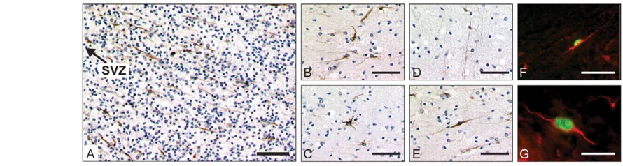Fig. 6. GFAPdKi67-positive nucleus (G, arrow). Scale bars: 100GFAP(E-H). At 13 gw, many Ki67-expressing nuclei were present in radial gliaof the VZ (B)
