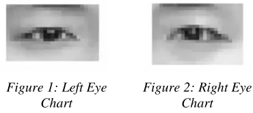Figure 1: Left Eye Chart 