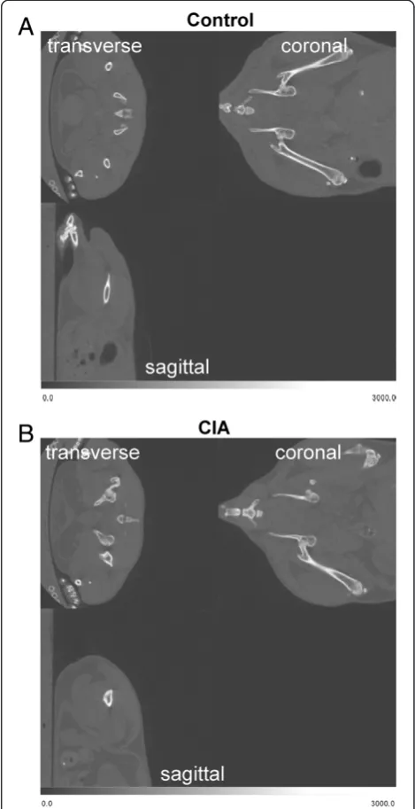 Figure 1 Visualization of the left femur bone by micro CT.Whole-body micro-CT images of a representative control (A) andCIA mouse at (B) week 0