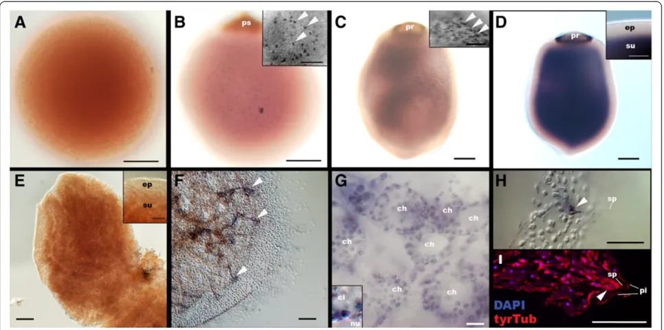 Figure 4 GATAB-D(E) mRNA expression during development in A. queenslandica. Late blastulae (A; sensu Leys and Degnan [10]), mid-stageembryos with a pigment spot (ps) (B), late-stage embryos with a pigment ring (pr) (C), a free-swimming larva (D), a settlem