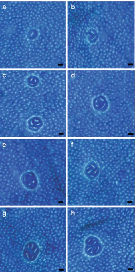 Fig. 2 a–mount. ACF are easily distinguished from surrounding normal colonich Examples of ACF in methylene blue-stained colon wholemucosa, bars=100 µm