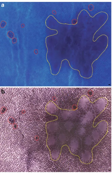Fig. 5 a Methylene blue-stained colon whole mount with severalACF circumscribed in red and GALT circumscribed in yellow