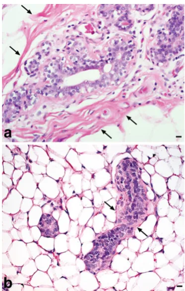 Fig. 1 Human breast vs. rat MG. a Normal human breast ductalepithelium surrounded by thick fibrous connective tissue (arrows),H&E, ×400, bar=10 µm