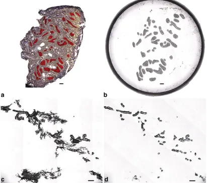 Fig. 3 a Unstained MA section showing AOIs marked in red. b Image of LCM cap showing captured epithelial AOIs