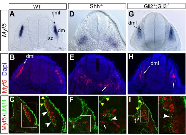 Fig. 1. Myotome patterning defect in the absence ofShh-Gli signalling correlates with loss of a laminin-containing myotomal basement membrane.(A-I) Myf5 (red) and β1 laminin (green) expression