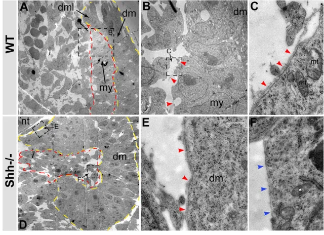 Fig. 2. The myotomal basement membrane fails