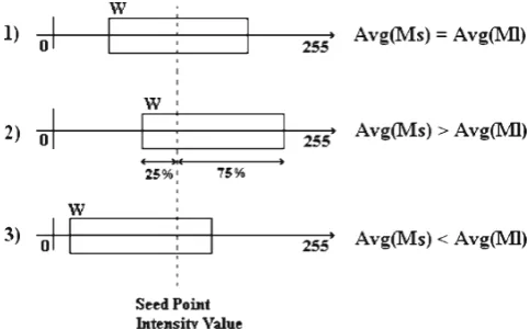 Fig 3. The concept of sliding window to adapt segmentation criterion.