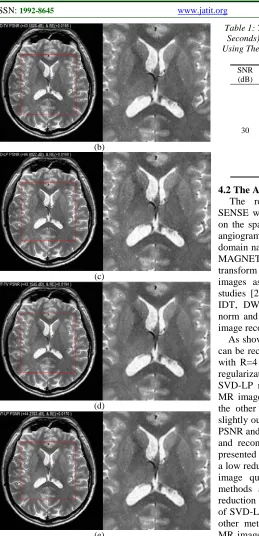 Table 1: The Psnrs, Res And Reconstruction TIME (In Seconds) Of The Reconstructed Brain MR Images By 