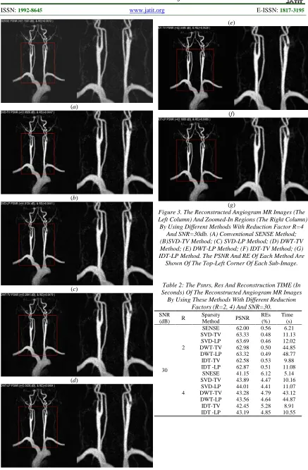 Table 2: The Psnrs, Res And Reconstruction TIME (In  Seconds) Of The Reconstructed Angiogram MR Images 
