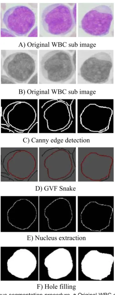 Fig. 3. Nucleus segmentation procedure. a Original WBC sub image. bOriginal WBC sub image