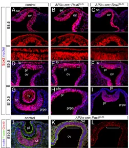 Fig. 4. Pre-placodal expression of Sox2Pax6placode; lv, lens vesicle; pr, presumptive retina; prpe; presumptiveretinal pigmented epithelium; ple, presumptive lens ectoderm; pi, lens((top), showing immunofluorescence signal for Sox2 (red) and nuclei(blue)