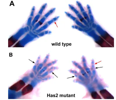 Fig. 3. Skeletal patterning and joint defects in the autopods ofHas2-deficient limbs. Alcian Blue/Alizarin Red-stained E16.5 forelimbautopods of wild-type (A) and Has2-deficient (B) mouse limbs