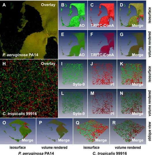 Fig. 6: 3D visualization of microbial biofilms using amira®. A. A 2D average of an image z-stack for a P