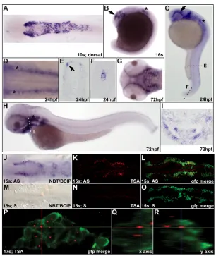 Fig. 1. disc1( expression in zebrafish CNC.A) Dorsal view of a 10s (14 hpf) embryo showing