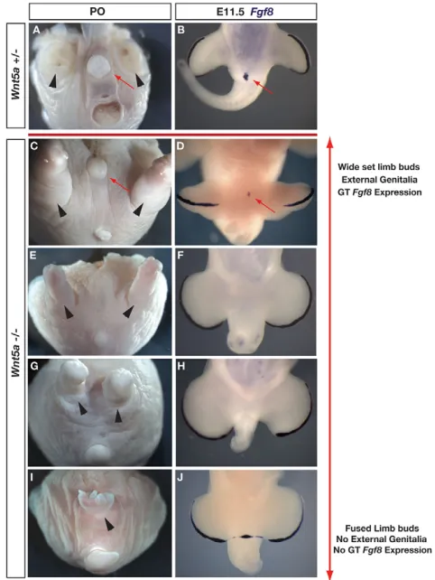 Fig. 1. Variably penetrant development of external genitalia inWnt5aWnt5aviews; tail is at the bottom of each panel