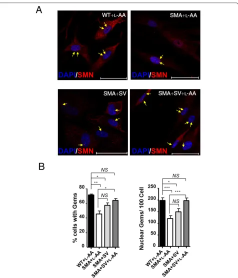 Figure 2 Combined treatment restores survival motor neuron (SMN) nuclear body gems in fibroblasts of a spinal muscular atrophy(SMA) patient