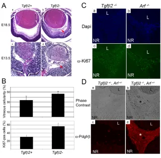 Fig. 1. Primary vitreous hyperplasia in Tgfb2–/––/– 
