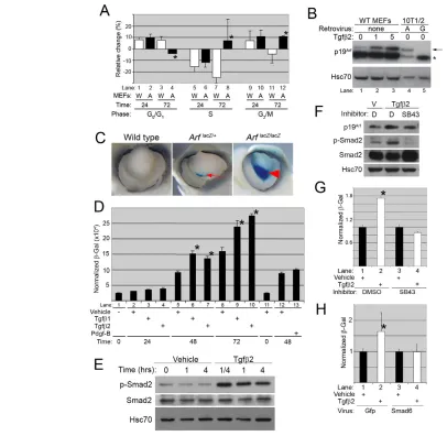 Fig. 2. Tgfβvehicle-treated MEFs are marked (*). (MEFs. Data represent the average change (and standard deviation) in cell cycle phase in Tgfincrease or decrease from vehicle-treated cells at 24 or 72 hours