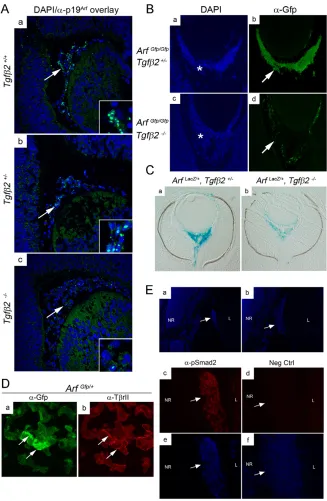 Fig. 4. Tgfb2 fosters Arf expression in the