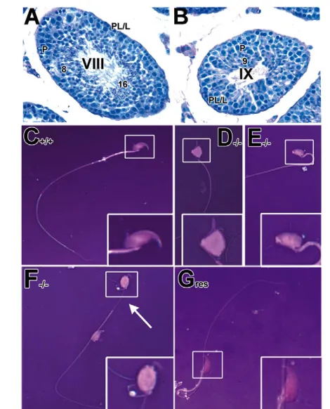 Fig. 5. Successful spermatid orientation, alignment and release atstage VIII and IX of the spermatogenic cycle in rescued adultThe arrow points to the thinned mid-piece of the tail