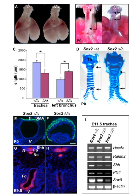 Fig. 2. Abnormal development of larynx and trachea in Nkx2.5-(bracket) and long main bronchus in P0 mutants (trachea in control (left) and mutant (right) mice