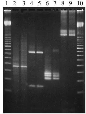 Figure 1 : Example of PCR amplification products using variousDNA targets with soil extracted by enzymatic lysis or beadbeating