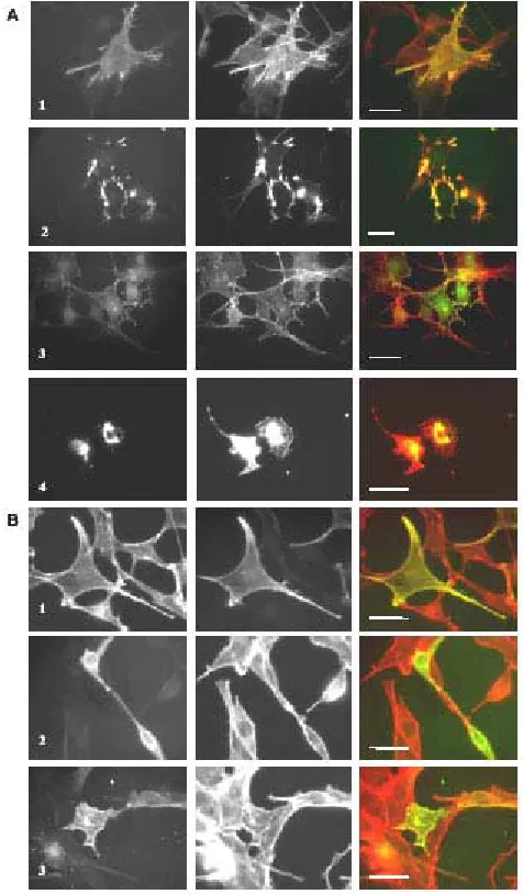 Fig. 4: Expression of GFP-tagged actin and mutants in NIH 3T3 cells  gives a different picture than expression of the myc-tagged versions