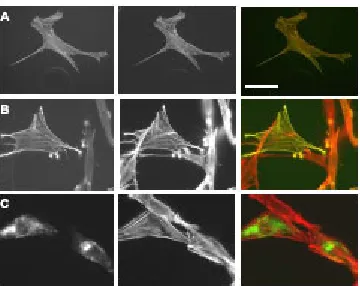 Fig. 7:  FITC staining of the expressed mutants, middle panels phalloidin staining of filamentous actin, right panels overlay (phalloidin: red, myc: green)