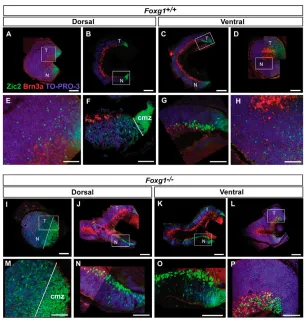 Fig. 3. Increased proportion of Zic2-expressing cells in nasalretina of as a proportion of numbers of Brn3a-positive cells in the four retinalquadrants