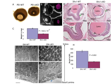Fig. 2. Sfrs1-cKO mice have small eyes at P0. (A)Frontal view of wild-type (WT) and Sfrs1-cKO eyes